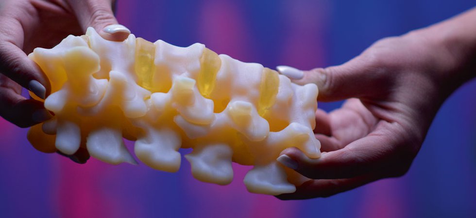 3D-printad ryggradsmodell i flexibelt material – används för medicinsk visualisering och kirurgisk planering